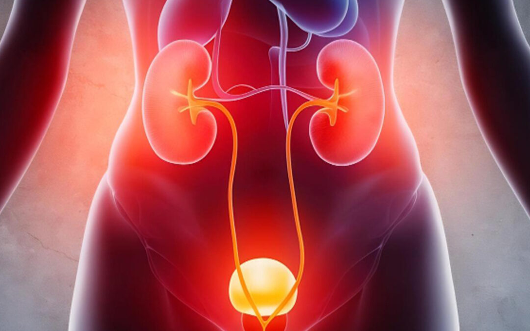 尿路感染的临床表现与症状