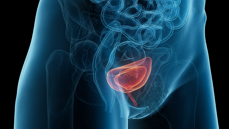 膀胱过度活动症的临床表现与症状