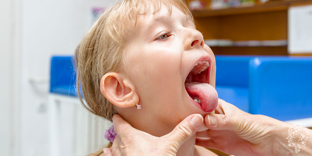 扁桃体炎的病理生理机制