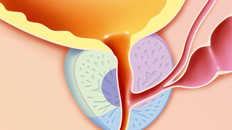 前列腺炎的病理生理机制