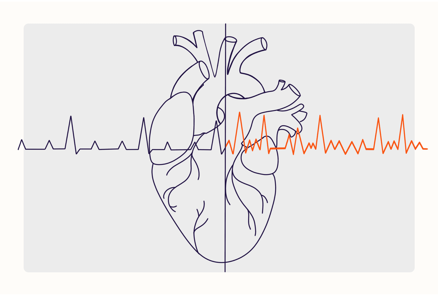 “心跳的旋律”：房颤与中风的致命联系