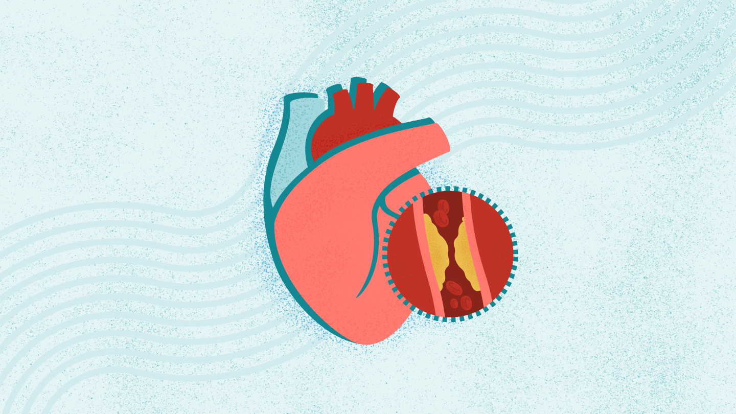 你的危险评分卡：冠心病的七大高危因素