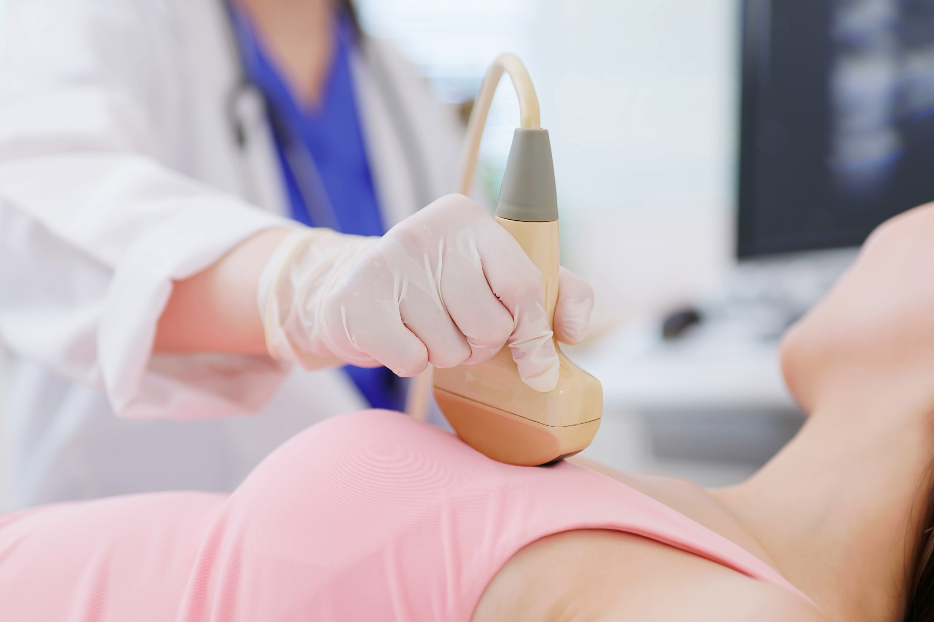 乳腺癌的生活方式调整策略