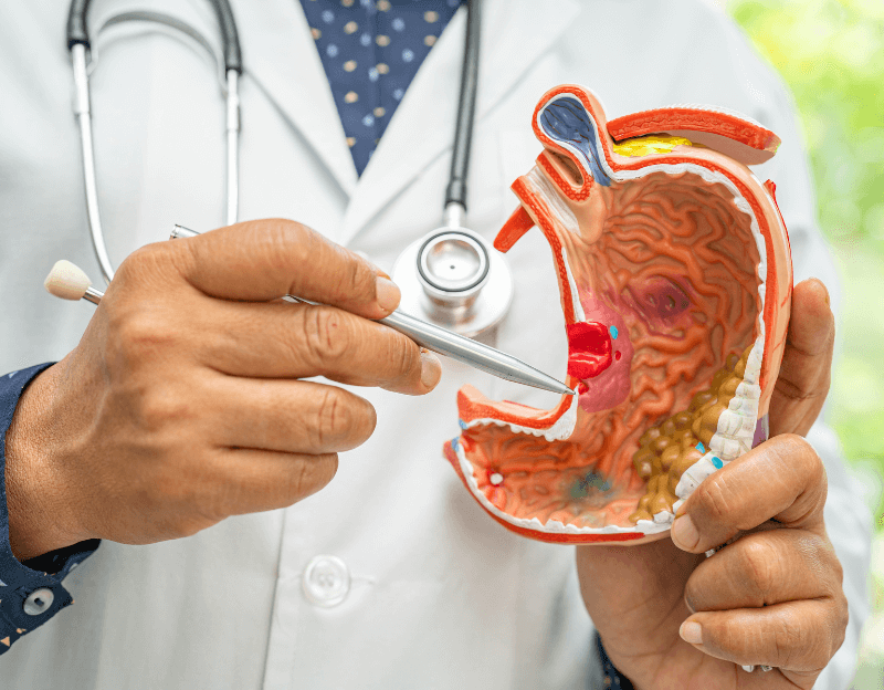 胃癌的临床表现与症状