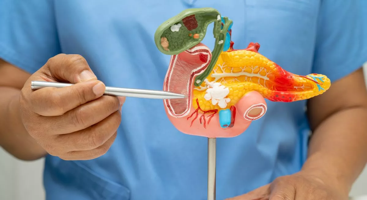 胰腺癌的疾病概述与定义