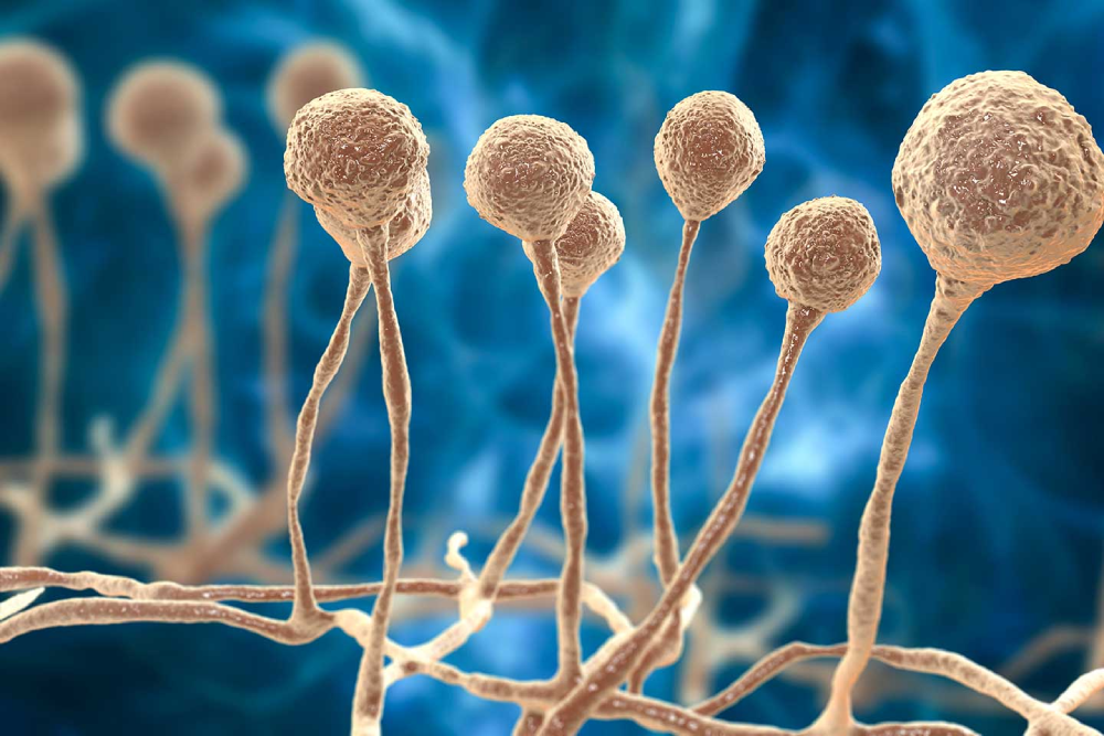 免疫低下的威胁：侵袭性真菌病的（1,3）-β-D葡聚糖、G/GM试验报告解读与抗真菌治疗