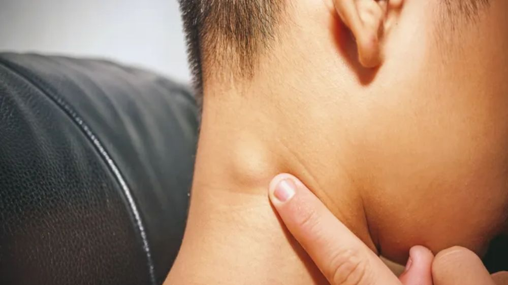 淋巴瘤的常规医疗治疗方案