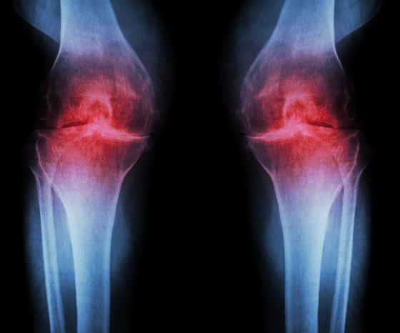 影像学检查指南：X光、MRI到底能看出什么“名堂”？